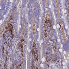 Immunohistochemical staining of human duodenum shows strong cytoplasmic positivity in lymphoid cells.