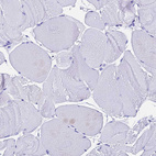 Immunohistochemical staining of human skeletal muscle shows no positivity in myocytes as expected.
