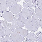Immunohistochemical staining of human skeletal muscle shows no positivity in myocytes as expected.