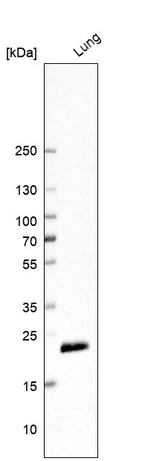 Western blot analysis in human lung tissue.