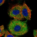 Immunofluorescent staining of human cell line A549 shows localization to cytosol.