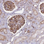 Anti-TTC4 Antibody
