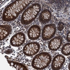 Anti-RNF165 Antibody