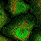 Immunofluorescent staining of human cell line HeLa shows localization to nucleus & plasma membrane.