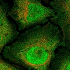 Immunofluorescent staining of human cell line HeLa shows localization to nucleus & plasma membrane.