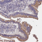 Anti-CYP2U1 Antibody