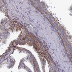 Immunohistochemical staining of human prostate shows strong granular cytoplasmic positivity in glandular cells.