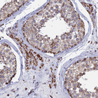 Immunohistochemical staining of human testis shows strong granular cytoplasmic positivity in Leydig cells and cells in seminiferous ducts.