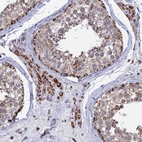 Immunohistochemical staining of human testis shows strong granular cytoplasmic positivity in Leydig cells and cells in seminiferous ducts.