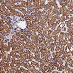 Immunohistochemical staining of human liver shows strong granular cytoplasmic positivity in hepatocytes.