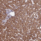 Immunohistochemical staining of human liver shows strong granular cytoplasmic positivity in hepatocytes.