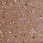 Immunohistochemical staining of human cerebral cortex shows positivity in neuronal processes.