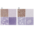 Immunohistochemical staining of human adrenal gland, cerebral cortex, endometrium and tonsil using Anti-FDX1 antibody HPA041630 (A) shows similar protein distribution across tissues to independent antibody HPA062087 (B).