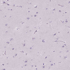 Immunohistochemical staining of human cerebral cortex shows no positivity in neuronal cells as expected.