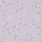 Immunohistochemical staining of human cerebral cortex shows no positivity in neuronal cells as expected.
