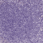 Immunohistochemical staining of human tonsil shows no positivity in germinal center cells as expected.