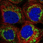 Immunofluorescent staining of human cell line A-431 shows localization to mitochondria.