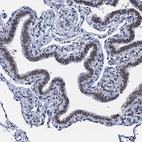 Immunohistochemical staining of human fallopian tube shows weak to moderate nuclear positivity in glandular cells.