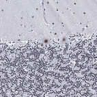Immunohistochemical staining of human cerebellum shows moderate to strong nuclear positivity in Purkinje cells.
