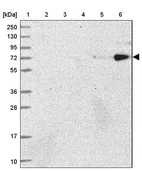 Lane 1: Marker [kDa] 250, 130, 95, 72, 55, 36, 28, 17, 10_br/_Lane 2: Human cell line RT-4_br/_Lane 3: Human cell line U-251MG sp_br/_Lane 4: Human plasma (IgG/HSA depleted)_br/_Lane 5: Human liver tissue_br/_Lane 6: Human tonsil tissue
