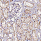 Immunohistochemical staining of human kidney shows moderate cytoplasmic positivity in cells in tubules.