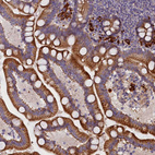Immunohistochemical staining of human gastrointestinal shows moderate cytoplasmic positivity in glandular cells.