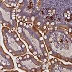 Immunohistochemical staining of human gastrointestinal shows moderate cytoplasmic positivity in glandular cells.