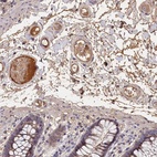 Anti-ITIH1 Antibody