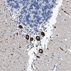 Anti-FREM3 Antibody