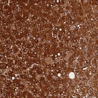 Anti-FAM118B Antibody