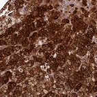 Anti-ACSBG1 Antibody