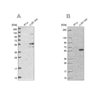 Western blot analysis using Anti-ACSBG1 antibody HPA041642 (A) shows similar pattern to independent antibody HPA058869 (B).