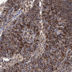 Anti-DGKA Antibody
