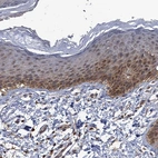 Immunohistochemical staining of human skin shows moderate cytoplasmic positivity in squamous epithelial cells.