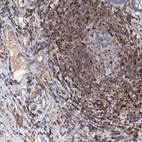 Immunohistochemical staining of human small intestine shows strong membranous positivity in lymphocytes.