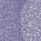 Immunohistochemical staining of human tonsil shows no positivity in non-germinal center cells as expected.