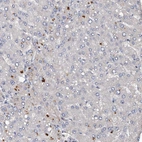 Immunohistochemical staining of human liver shows no positivity in hepatocytes as expected.