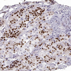Immunohistochemical staining of human pituitary gland shows moderate to strong nuclear positivity in neuroendocrine cells in the anterior lobe.