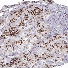 Immunohistochemical staining of human pituitary gland shows moderate to strong nuclear positivity in neuroendocrine cells in the anterior lobe.
