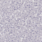 Immunohistochemical staining of human liver shows no positivity in hepatocytes as expected.