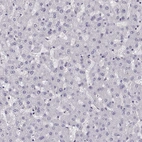 Immunohistochemical staining of human liver shows no positivity in hepatocytes as expected.
