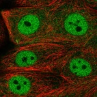 Immunofluorescent staining of human cell line MCF7 shows localization to nucleoplasm & cytosol.