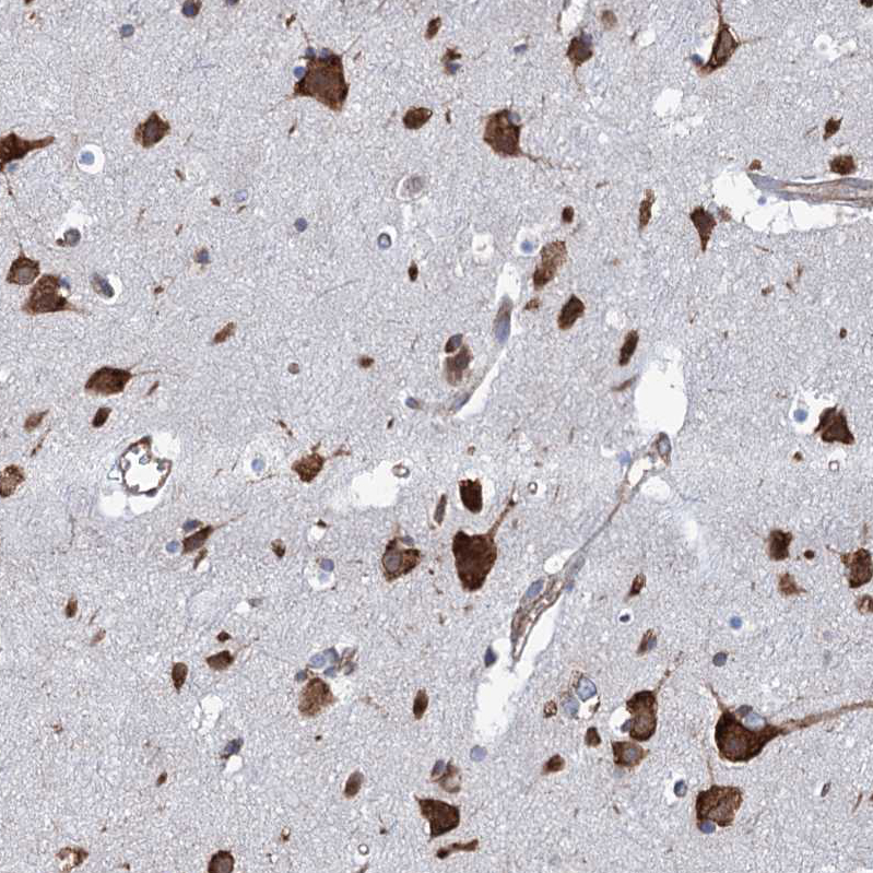 Anti-SLC12A7 Antibody
