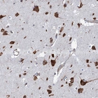 Anti-SLC12A7 Antibody