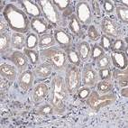 Immunohistochemical staining of human kidney shows moderate cytoplasmic positivity in cells in tubules.