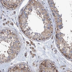 Immunohistochemical staining of human testis shows moderate cytoplasmic positivity in cells in seminiferous ducts and Leydig cells.