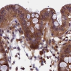 Immunohistochemical staining of human colon using Anti-NUBP1 antibody HPA041656.