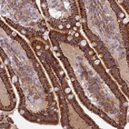Anti-CORO7 Antibody