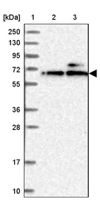 Lane 1: Marker [kDa] 250, 130, 95, 72, 55, 36, 28, 17, 10_br/_Lane 2: Human cell line RT-4_br/_Lane 3: Human cell line U-251MG sp