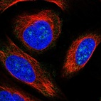 Immunofluorescent staining of human cell line U-2 OS shows localization to nucleoli.